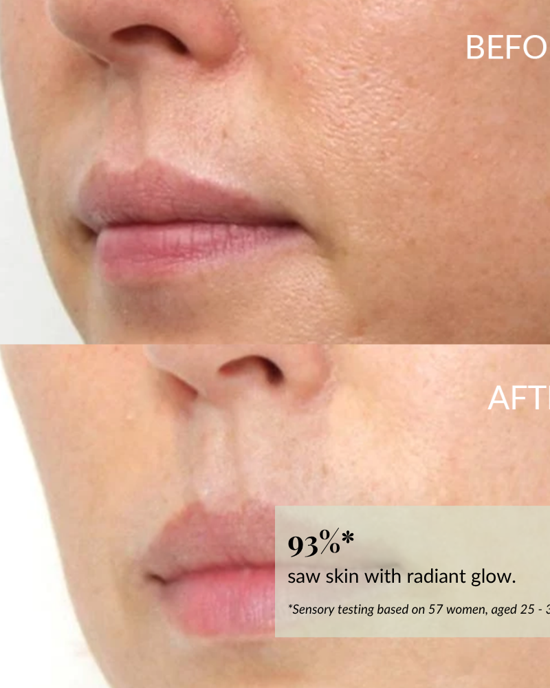 Close-up of the lower face shows smoother, more radiant skin after using IREN Shizen BLOOM OF YOUTH Restoring Facial Oil with prebiotics & postbiotics; text box highlights a 93% improvement compared to before.