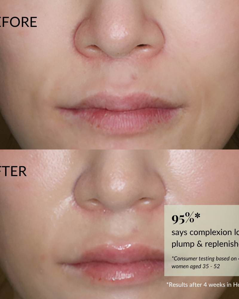 Close-up of a woman’s lower face shows skin before and after using IREN Shizen FREEZE THE YOUTH Hydra Firming Cream; after use, skin appears smoother and more hydrated—95% saw an improved complexion.