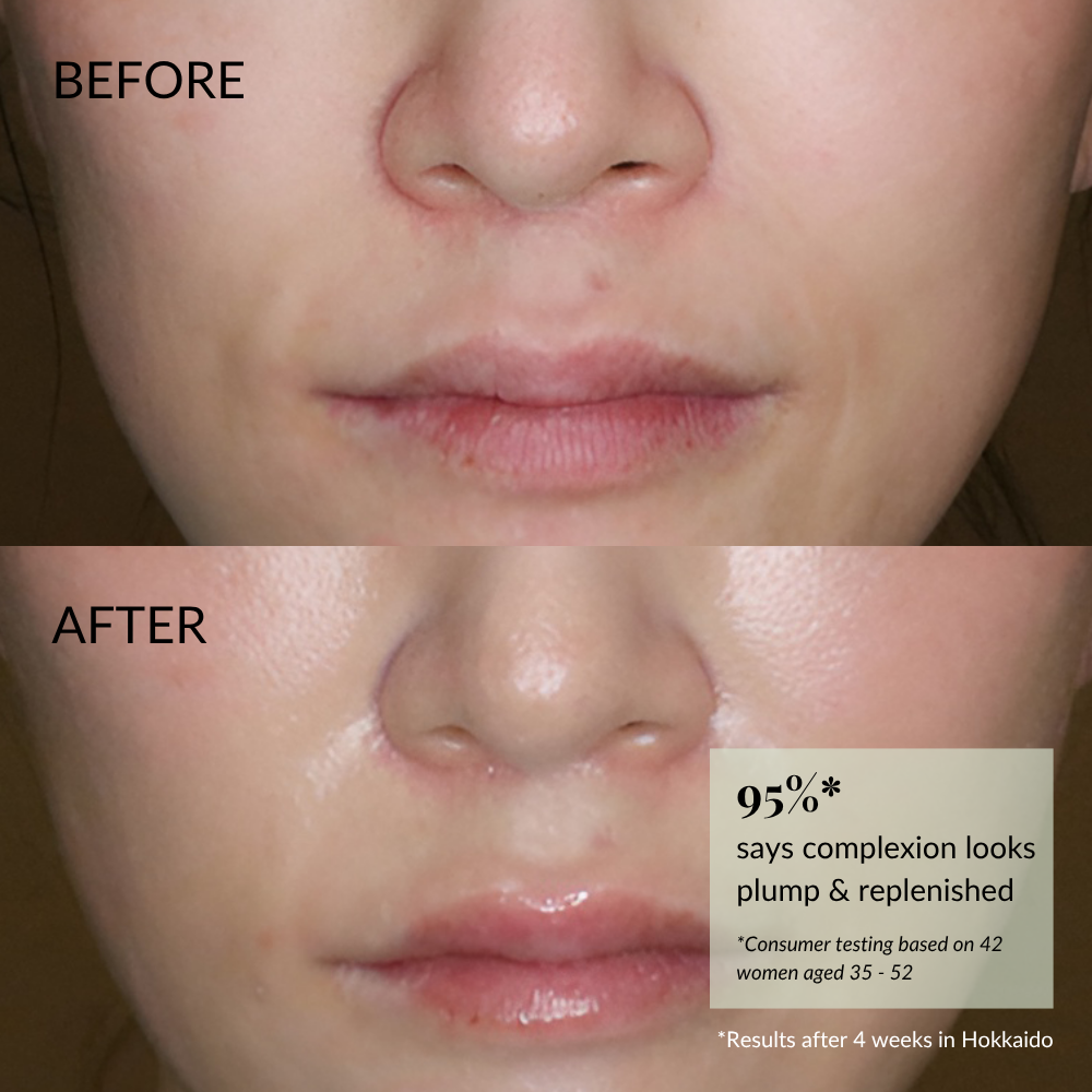 Close-up of a woman’s lower face shows skin before and after using IREN Shizen FREEZE THE YOUTH Hydra Firming Cream; after use, skin appears smoother and more hydrated—95% saw an improved complexion.