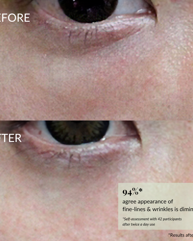 Close-up of skin near the eye, showing "before" with fine lines and "after" with smoother texture; highlights wrinkle improvement stats from using IREN Shizen's TIMELESS ELIXIR Multi-Lift Eye and Lip Cream, a potent anti-aging serum.