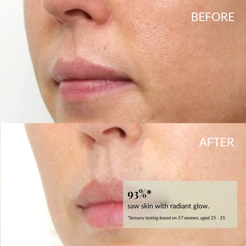 Close-up of the lower face shows smoother, more radiant skin after using IREN Shizen BLOOM OF YOUTH Restoring Facial Oil with prebiotics & postbiotics; text box highlights a 93% improvement compared to before. #show-lang-en