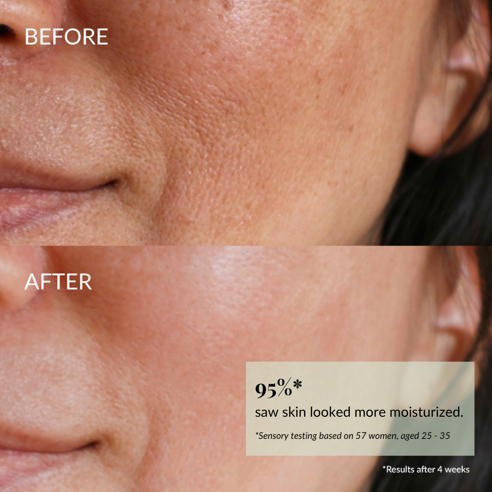 Close-up comparison of a woman's cheek before and after using the IREN Shizen DEW UP Hydrating Discovery Kit, highlighting visibly smoother texture and dewy skin in the "after" image. #show-lang-en