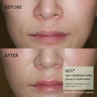 Close-up of a woman’s lower face shows skin before and after using IREN Shizen FREEZE THE YOUTH Hydra Firming Cream; after use, skin appears smoother and more hydrated—95% saw an improved complexion.